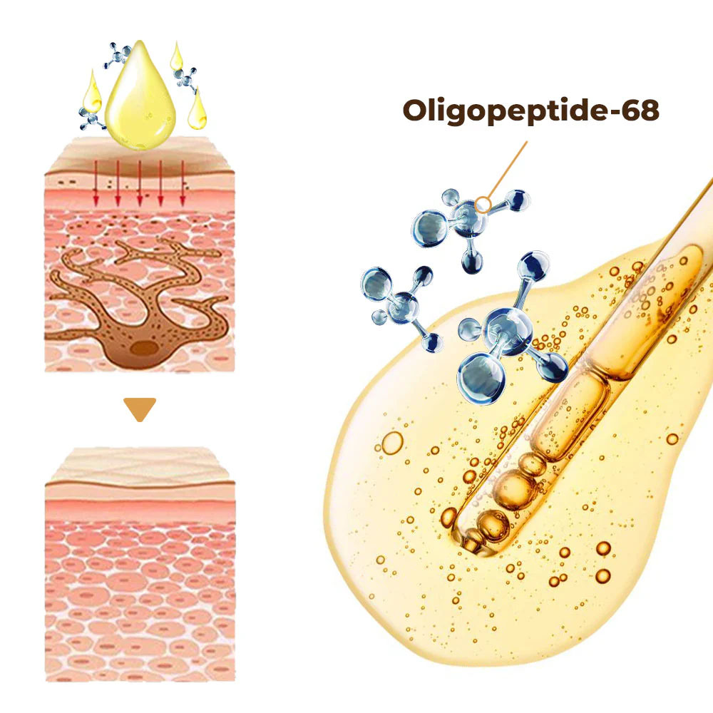 Oligopeptide 68 và tác dụng trong điều trị nám, tàn nhang