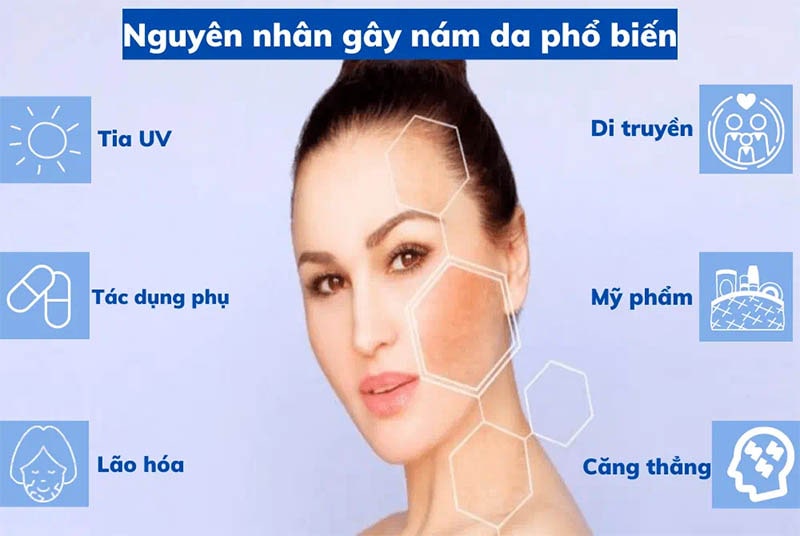 Phòng chống nám da dựa trên nguyên nhân gây nám