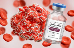 tranexamic-acid-tri-nam